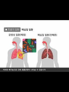 [x]호흡곤란의 원인 - YouTube