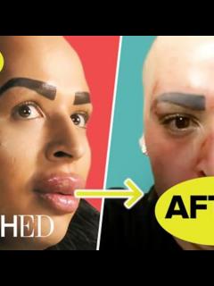 [x]The Most Insane Lips on "Botched"