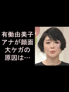 [x]有働由美子アナが顔面大ケガの原因は…news zero降板発表後に衝撃姿、飲酒トラブルや殴られた疑惑も。画像あり - YouTube
