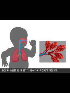 [x]신생아호흡곤란증후군의 개념 - YouTube