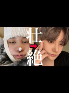 [x]整形総金額が1000万円を超えました😨 - YouTube